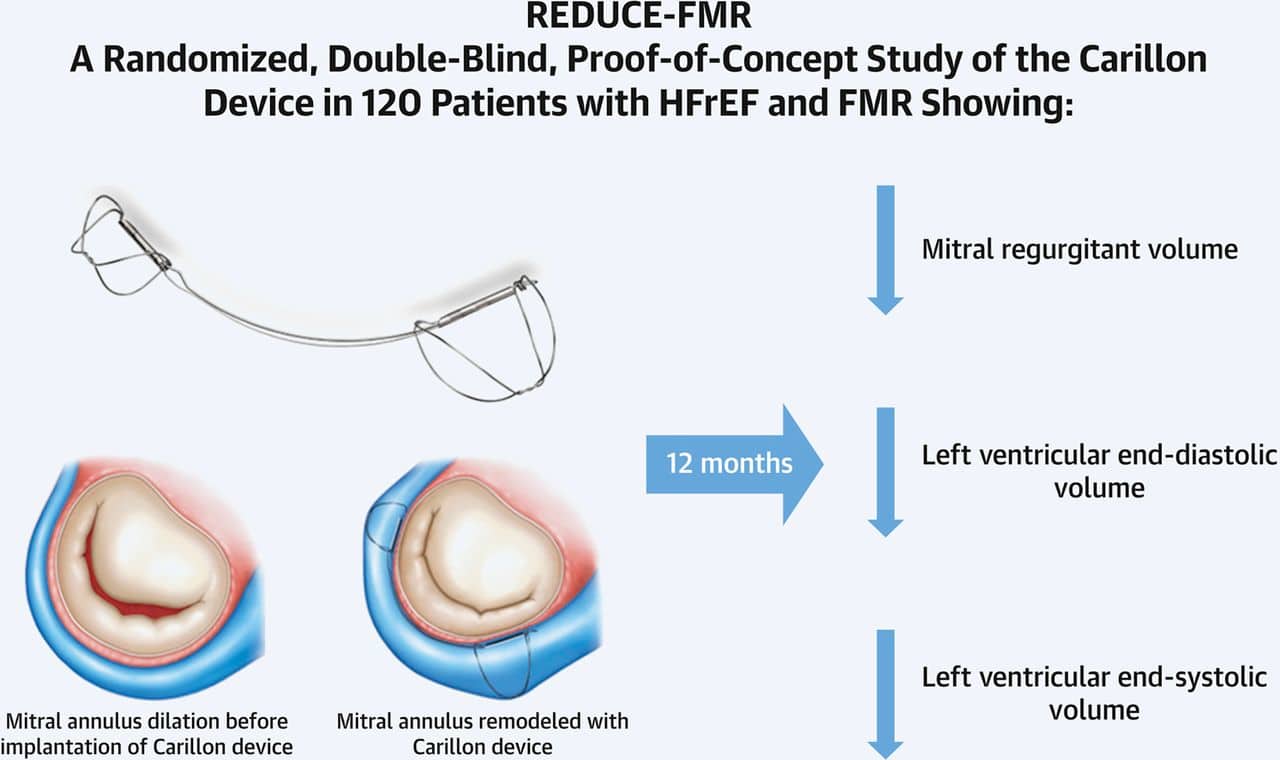 REDUCE-FMR Clinical Study Results - Carillon Cardiac Dimensions